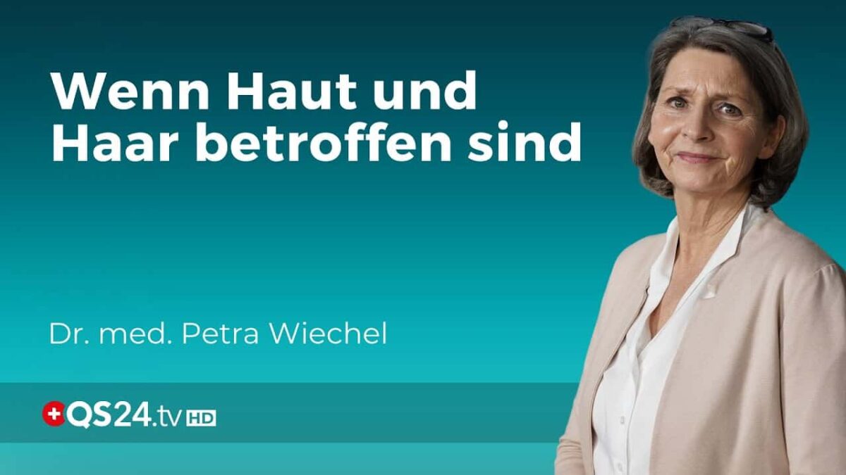 Lichen Planus und FFA (Haarausfall): Eine komplexe dermatologische Verbindung | Dr. Wiechel | QS24