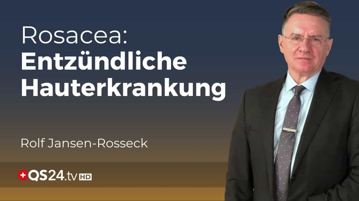 Rosacea: Sie müssen mit NICHT mit dieser Hauterkrankung leben!  | Unter der Lupe | QS24